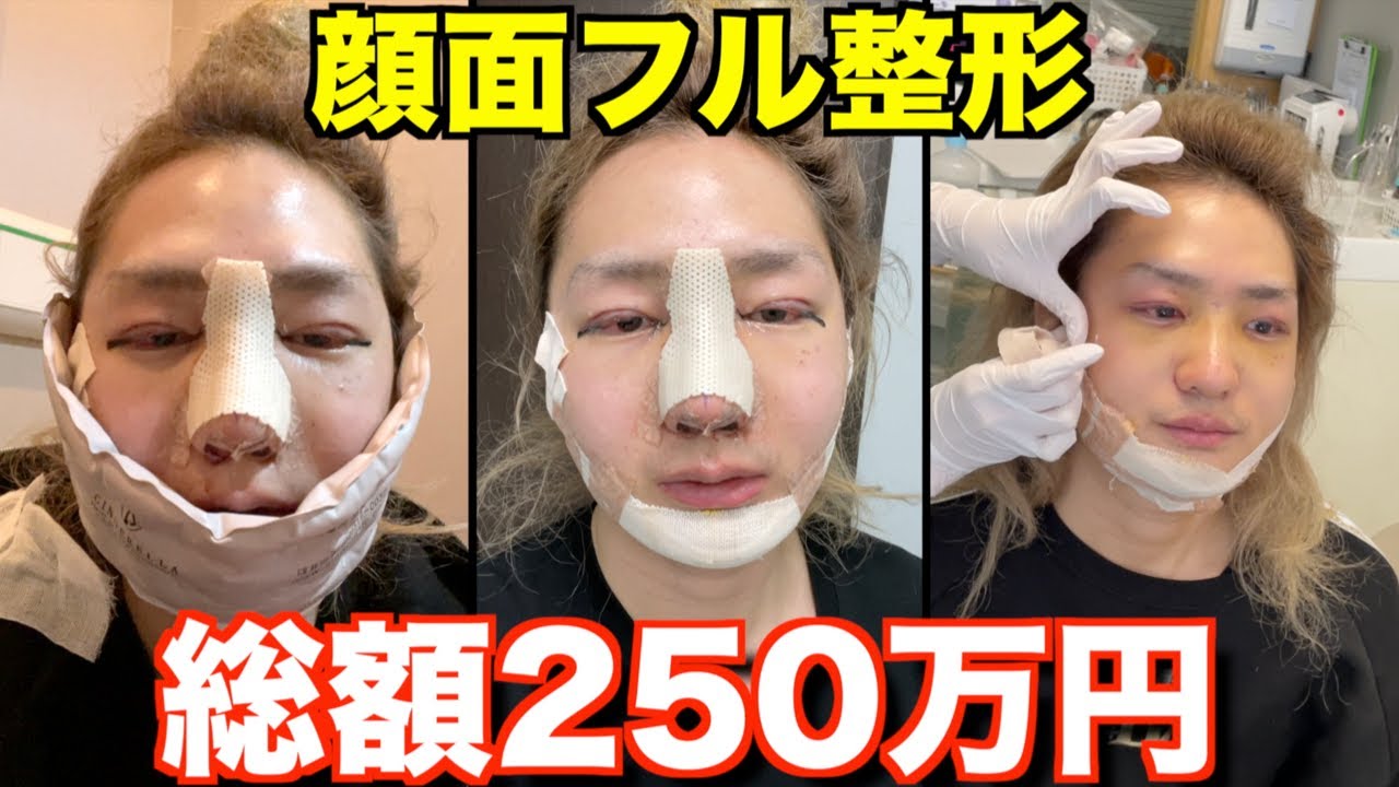 DJ社長 整形手術