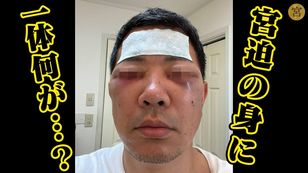 宮迫 整形